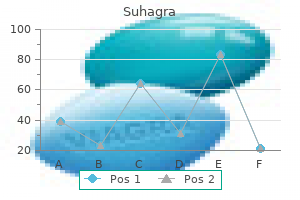 generic 100 mg suhagra with visa