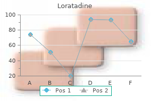 trusted 10 mg loratadine