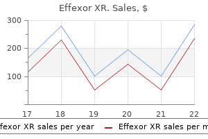 effexor xr 150mg with amex