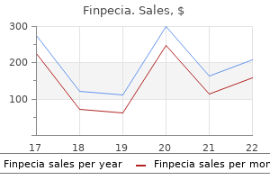 finpecia 1mg for sale