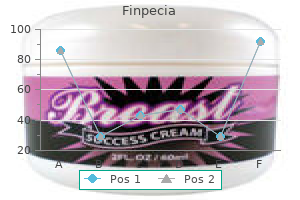 order generic finpecia on-line