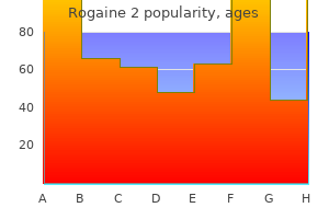 buy rogaine 2 60ml with visa