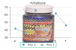 order 250 mg antabuse otc