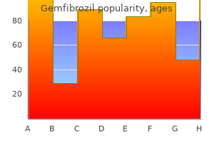 300mg gemfibrozil amex