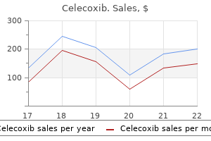 generic 200 mg celecoxib overnight delivery