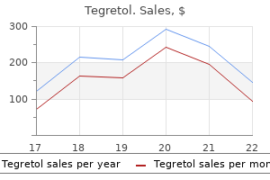 discount tegretol 400 mg overnight delivery