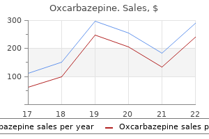 order 150 mg oxcarbazepine
