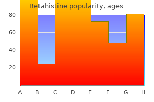 purchase betahistine without prescription