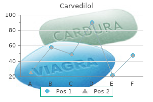 cheap 25mg carvedilol amex