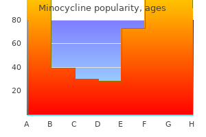 buy on line minocycline