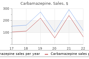 purchase carbamazepine american express